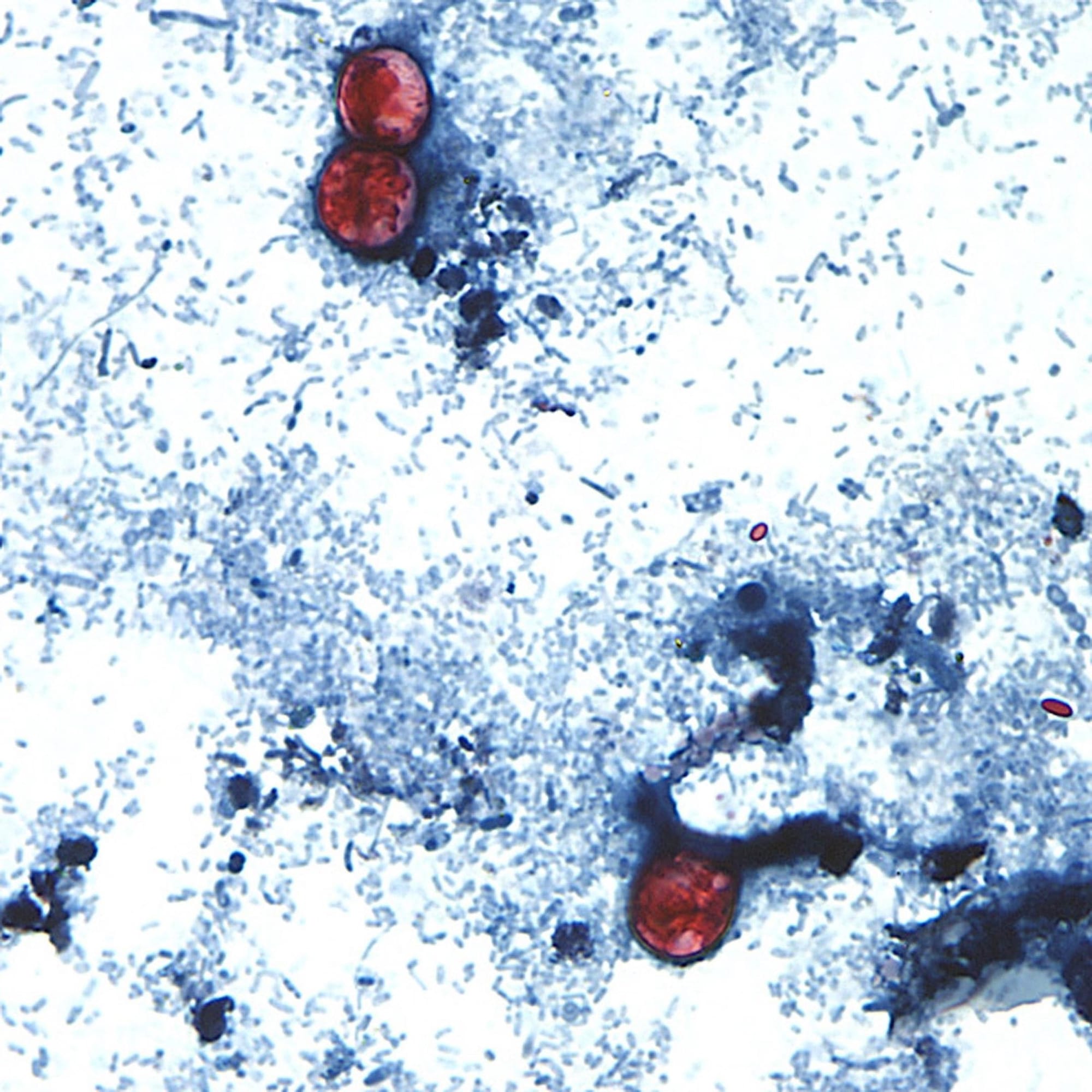 Test results create confusion around cyclosporiasis outbreak