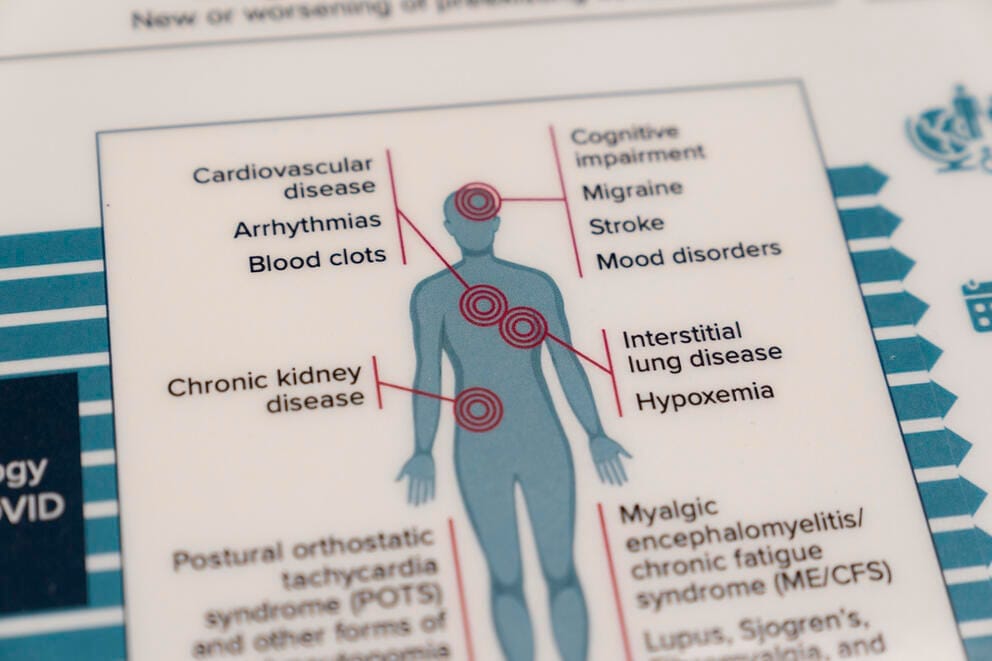 A diagram of an body shows symptoms of COVID