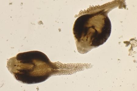 a microscope image of two parasites